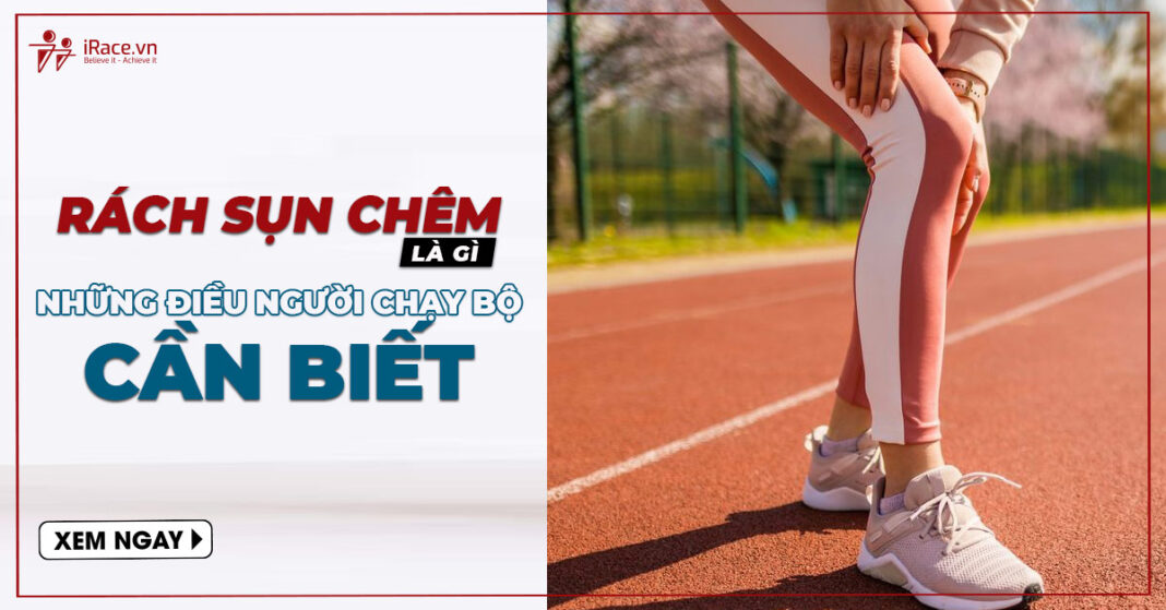 runner can biet ve rach sun chem